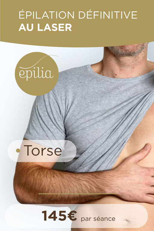 epilation-laser-torse-tournai-mob